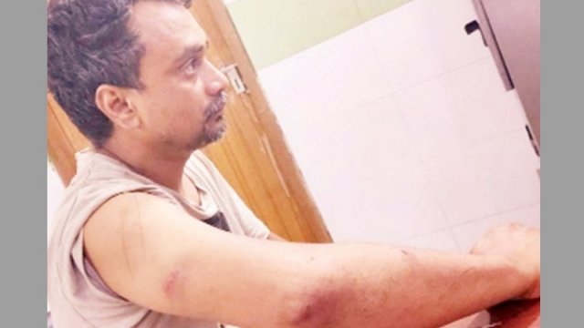 চোর সন্দেহে ব্যবসায়ীকে নির্যাতনের অভিযোগ ছাত্রলীগ নেতার বিরুদ্ধে | বিবিধ নিউজ 