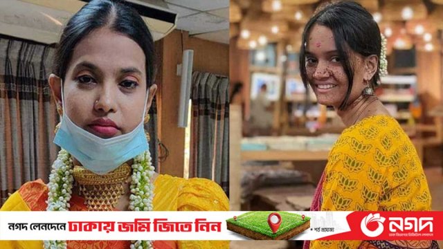 সারাহর মরণোত্তর কিডনি নেয়া শামীমাও মারা গেলেন | বিবিধ নিউজ 