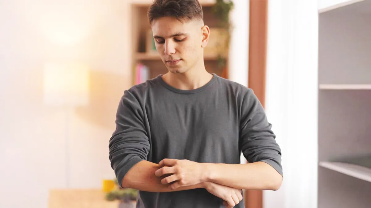 Ways to get rid of itching and rashes in summer