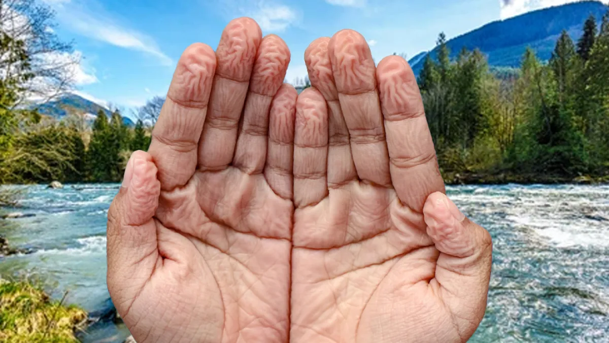 Why your fingers wrinkle in water (and what it can reveal about your health)