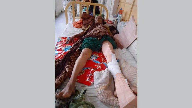শিক্ষিকার পা ভেঙে দিলো প্রতিপক্ষ | স্কুল নিউজ 