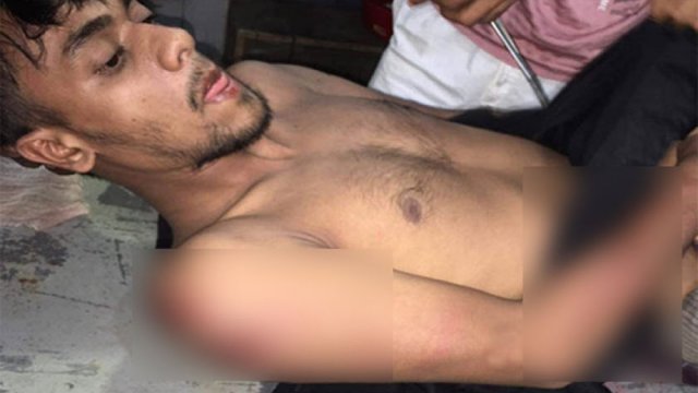 কোচিং না করায় শিক্ষার্থীকে রড দিয়ে পেটালেন শিক্ষক | মেডিকেল নিউজ 