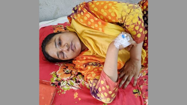 প্রচন্ড ব্যাথা নিয়ে নির্ঘুম রাত কাটাচ্ছেন চোখ হারানো সেই শিক্ষিকা | বিবিধ নিউজ 