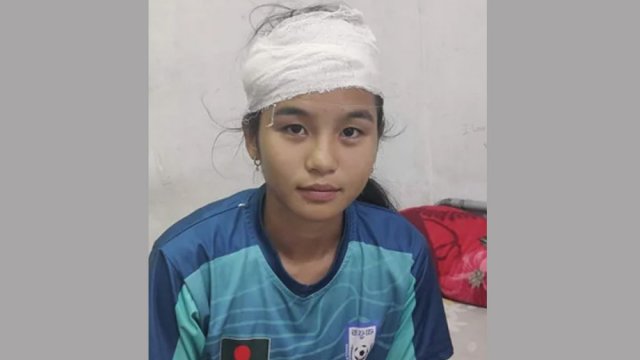 ছাদখোলা বাসে বিলবোর্ডের আঘাতে আহত ঋতুপর্ণা | খেলাধুলা নিউজ 