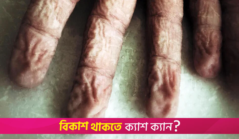 Why your fingers wrinkle in water (and what it can reveal about your health) | Lifestyle News 