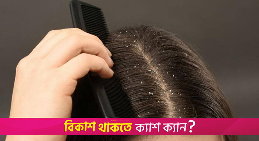 Five fruits to keep hair healthy and strong | Lifestyle News 